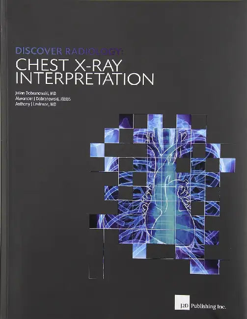 Discover Radiology: Chest X-Ray Interpretation by Julian Dobranowski