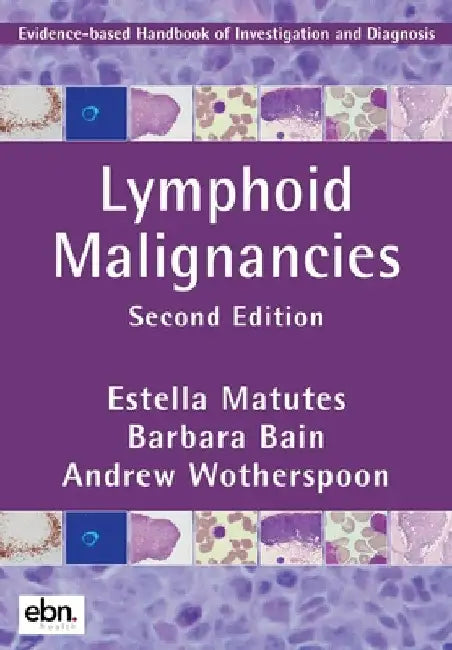 Lymphoid Malignancies by Estella Matutes