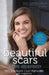 Beautiful Scars: A Life Redefined by Kilee Brookbank