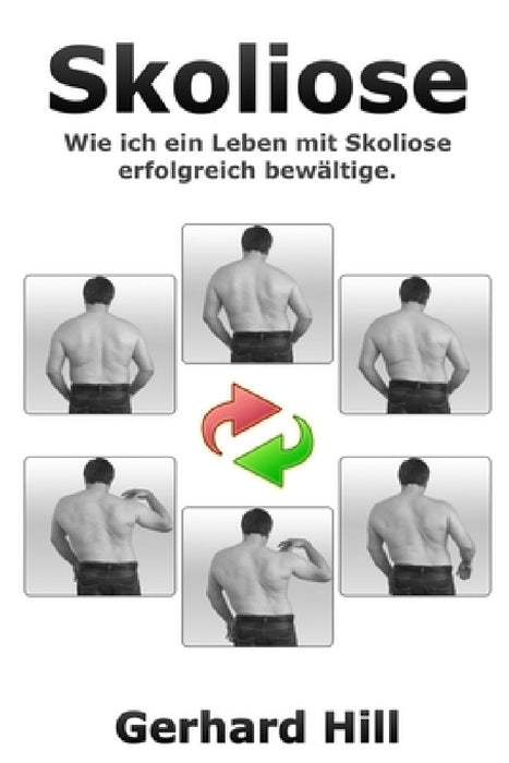 Skoliose: Wie ich ein Leben mit Skoliose erfolgreich bewältige by Gerhard Hill, Ralf Koch