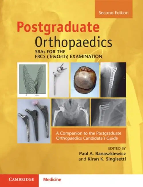 Sbas for the Frcs (Tr&orth) Examination: A Companion to the Postgraduate Orthopaedics Candidate's Guide by Paul A. Banaszkiewicz