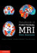 Handbook of Functional MRI Data Analysis by Russell A. Poldrack
