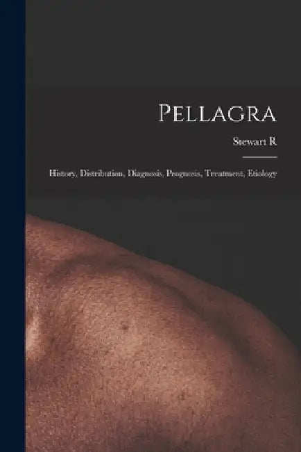 Pellagra: History, Distribution, Diagnosis, Prognosis, Treatment, Etiology by Stewart R. 1878-1941 Roberts