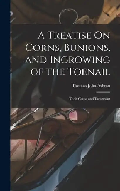 A Treatise On Corns, Bunions, and Ingrowing of the Toenail: Their Cause and Treatment by Thomas John Ashton