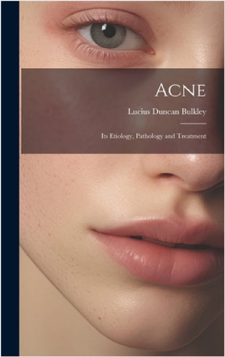 Acne: Its Etiology, Pathology and Treatment by Lucius Duncan Bulkley