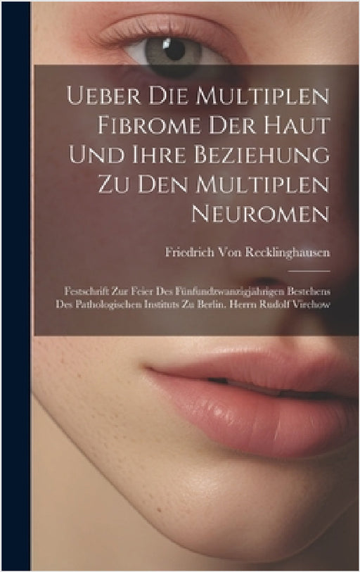 Ueber Die Multiplen Fibrome Der Haut Und Ihre Beziehung Zu Den Multiplen Neuromen: Festschrift Zur Feier Des Fünfundzwanzigjährigen Bestehens Des Path by Friedrich Von Recklinghausen