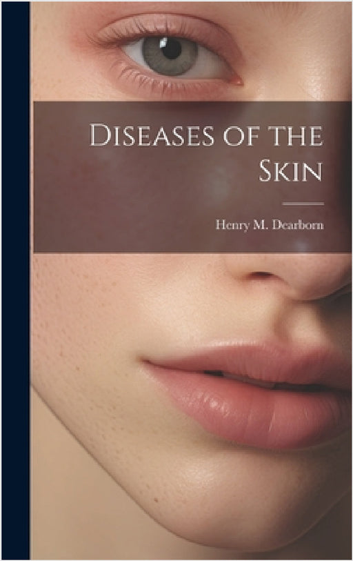 Diseases of the Skin by Henry M. Dearborn