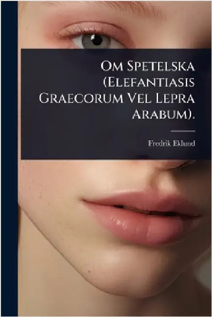 Om Spetelska (Elefantiasis Graecorum Vel Lepra Arabum). by Fredrik Eklund