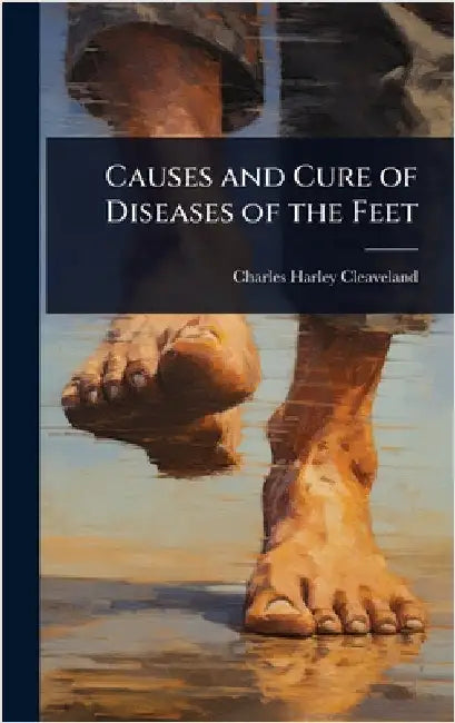 Causes and Cure of Diseases of the Feet by Charles Harley Cleaveland