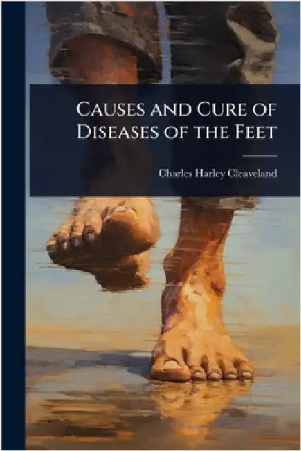 Causes and Cure of Diseases of the Feet by Charles Harley Cleaveland