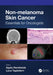 Non-Melanoma Skin Cancer: Essentials for Oncologists by Agata Rembielak