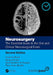Neurosurgery by Elwell, Vivian A.