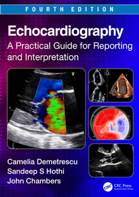 Echocardiography: A Practical Guide for Reporting and Interpretation by Camelia Demetrescu