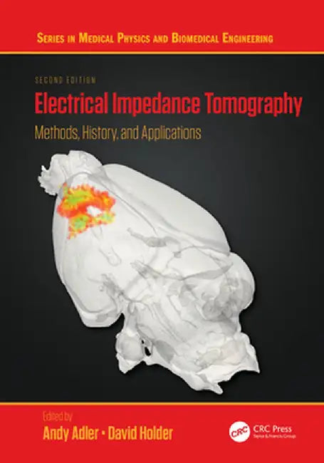 Electrical Impedance Tomography: Methods, History and Applications by Andy Adler