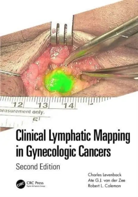 Clinical Lymphatic Mapping in Gynecologic Cancers by Charles Levenback
