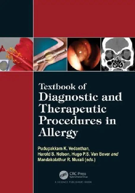 Textbook of Diagnostic and Therapeutic Procedures in Allergy by Pudupakkam K. Vedanthan