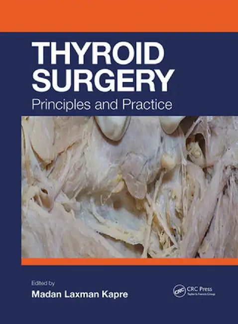 Thyroid Surgery: Principles and Practice by Madan Kapre
