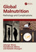 Global Malnutrition: Pathology and Complications by Jahangir Moini, Oyindamola Akinso, Raheleh Ahangari