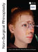 Non-Surgical Rhinoplasty by Dario Bertossi