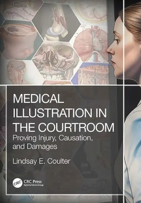 Medical Illustration in the Courtroom: Proving Injury, Causation, and Damages by Lindsay E. Coulter