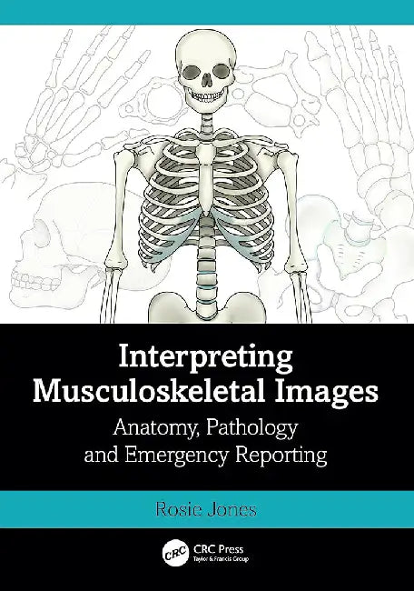 Interpreting Musculoskeletal Images by Jones, Rosie