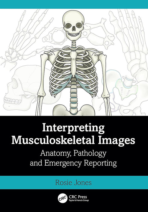 Interpreting Musculoskeletal Images by Jones/Rosie