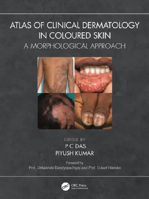 Atlas of Clinical Dermatology in Coloured Skin: A Morphological Approach by P. C. Das