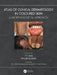 Atlas of Clinical Dermatology in Coloured Skin: A Morphological Approach by P. C. Das