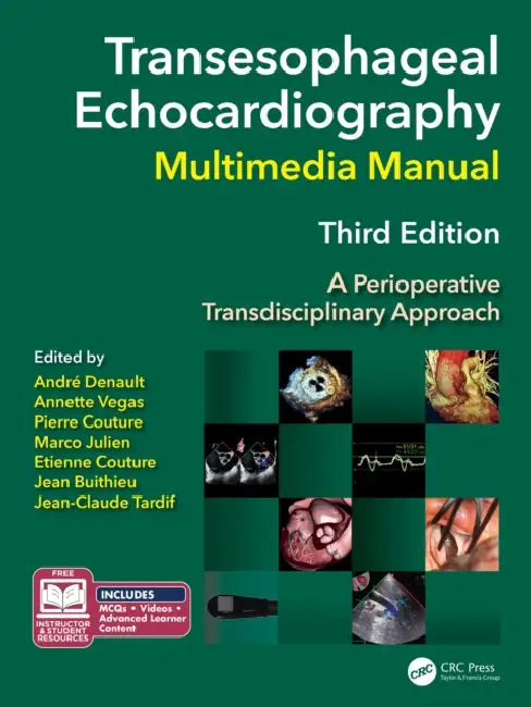 Transesophageal Echocardiography Multimedia Manual by André Y. Denault