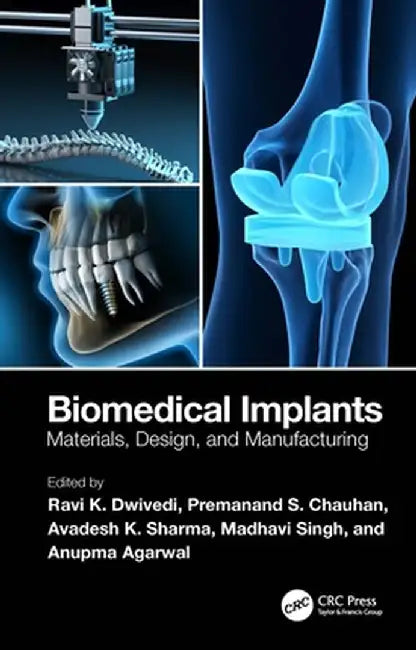 Biomedical Implants: Materials, Design, and Manufacturing by Ravi K. Dwivedi