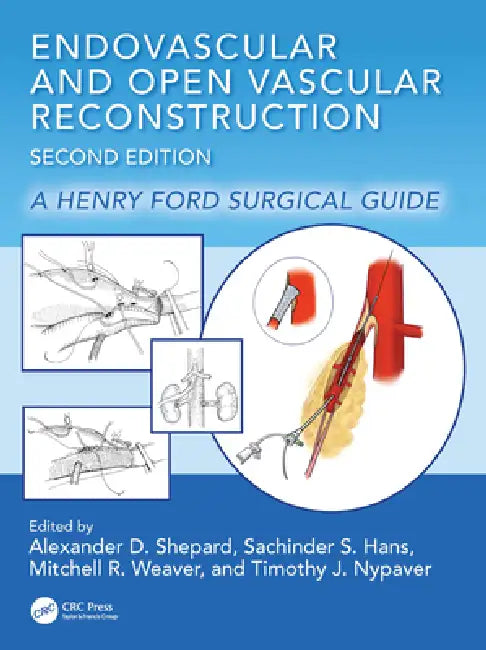 Endovascular and Open Vascular Reconstruction: A Henry Ford Surgical Guide by Alexander D. Shepard