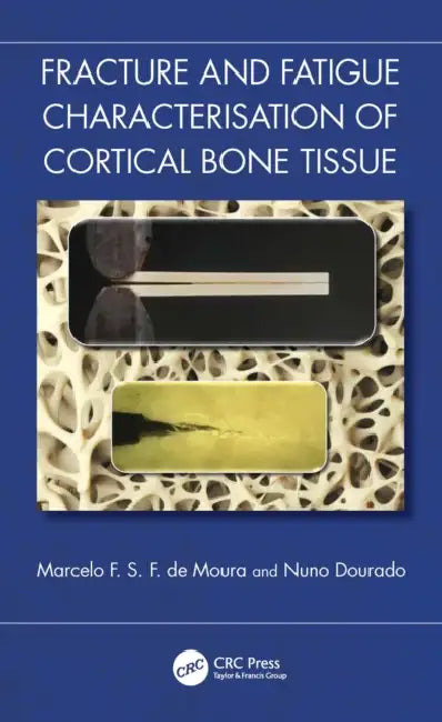 Fracture and Fatigue Characterisation of Cortical Bone Tissue by Marcelo F. S. F. de Moura