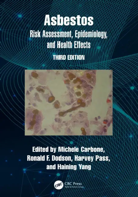 Asbestos: Risk Assessment, Epidemiology, and Health Effects by Michele Carbone, Ronald Dodson, Harvey Pass