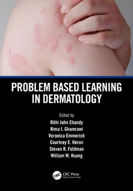 Problem Based Learning in Dermatology by Rithi John Chandy