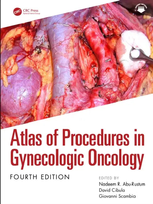 Atlas of Procedures in Gynecologic Oncology by Nadeem R. Abu-Rustum