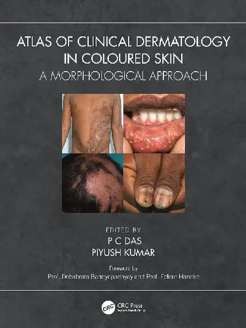 Atlas Of Clinical Dermatology In Coloured Skin A Morphological Approach by Das P.C.