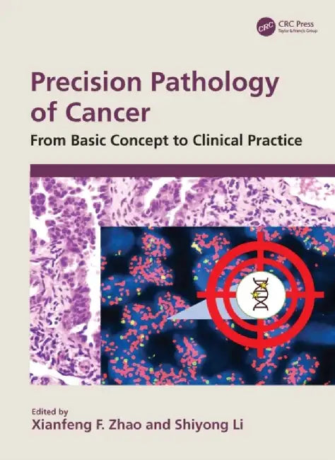 Precision Pathology of Cancer: From Basic Concept to Clinical Practice by Xianfeng F. Zhao