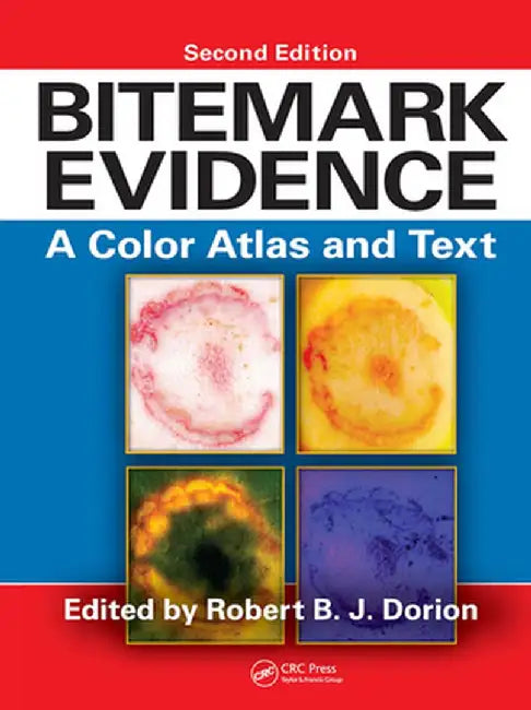 Bitemark Evidence: A Color Atlas and Text, 2nd Edition by Robert B.J. Dorion