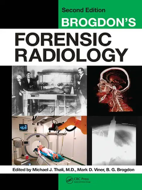 Brogdon's Forensic Radiology by M.D. Thali