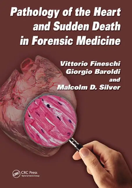 Pathology of the Heart and Sudden Death in Forensic Medicine by Vittorio Fineschi