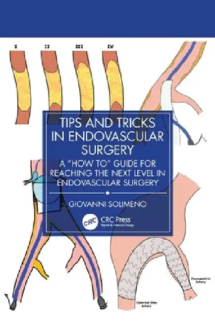 Tips and Tricks in Endovascular Surgery: A "How to" Guide for reaching the next Level in Endovascular Surgery by Giovanni Solimeno
