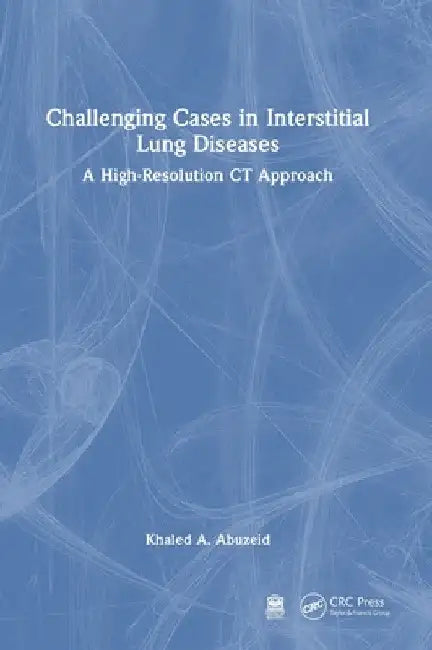 Challenging Cases in Interstitial Lung Diseases: A High-Resolution CT Approach by Khaled A. Abuzeid