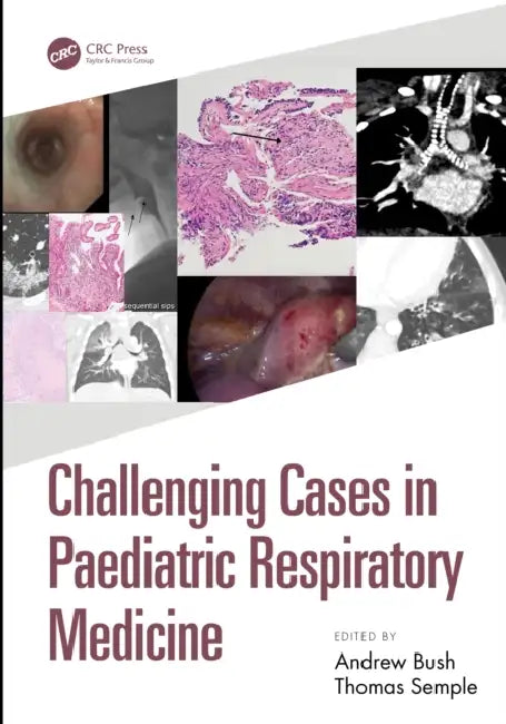 Challenging Cases in Paediatric Respiratory Medicine by Andrew Bush, Thomas Semple