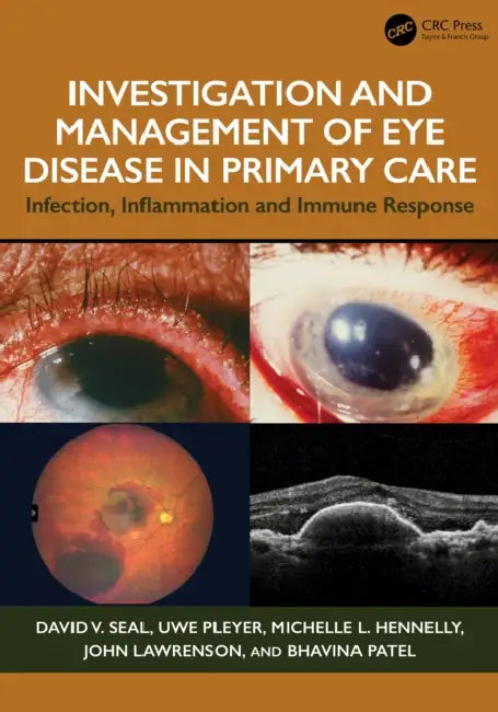 Investigation & Management of Eye Disease in Primary Care: Infection, Inflammation and Immune Response by David V. Seal, Uwe Pleyer, Michelle L. Hennelly