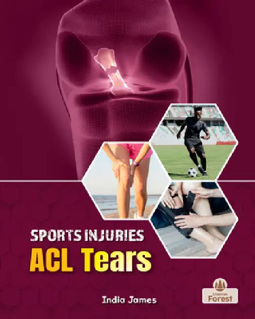ACL Tears by India James