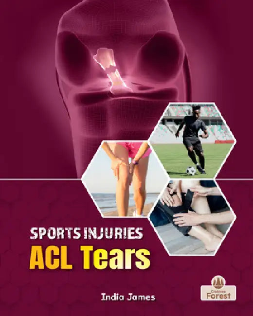 ACL Tears by India James