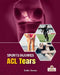 ACL Tears by India James