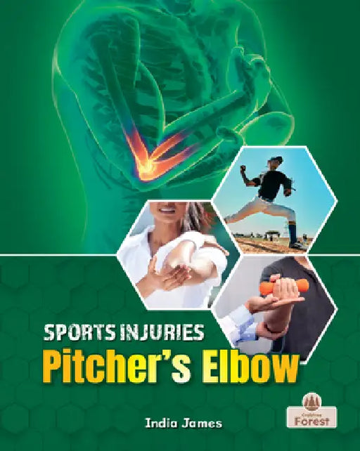 Pitcher's Elbow by India James