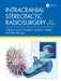 Intracranial Stereotactic Radiosurgery by Jason P. Sheehan