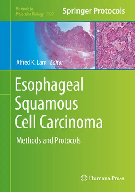 Esophageal Squamous Cell Carcinoma: Methods and Protocols by Alfred K. Lam